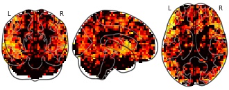 glassbrain