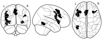 glassbrain