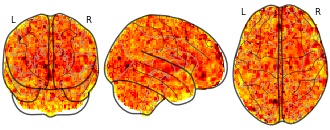 glassbrain