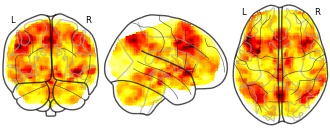 glassbrain