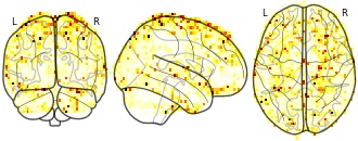 glassbrain