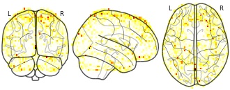 glassbrain