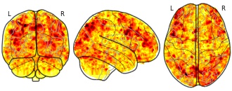 glassbrain