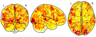 glassbrain