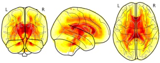 glassbrain