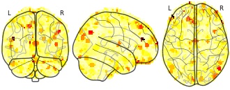 glassbrain