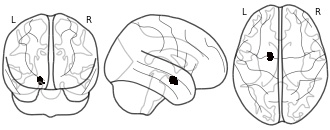 glassbrain