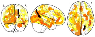 glassbrain