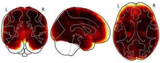 glassbrain