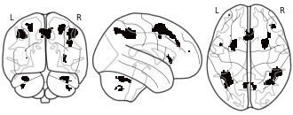glassbrain
